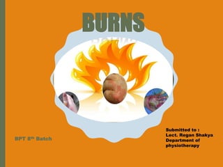 BURNS
BPT 8th Batch
Submitted to :
Lect. Regan Shakya
Department of
physiotherapy
 