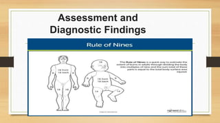 Assessment and
Diagnostic Findings
 