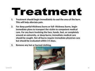 Burn related safety training during welding | PPT
