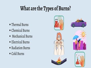 Burn Net Types TYPES OF BURNS , ITS TYPES AND PHOTOS OF ALL TYPES | PPTX