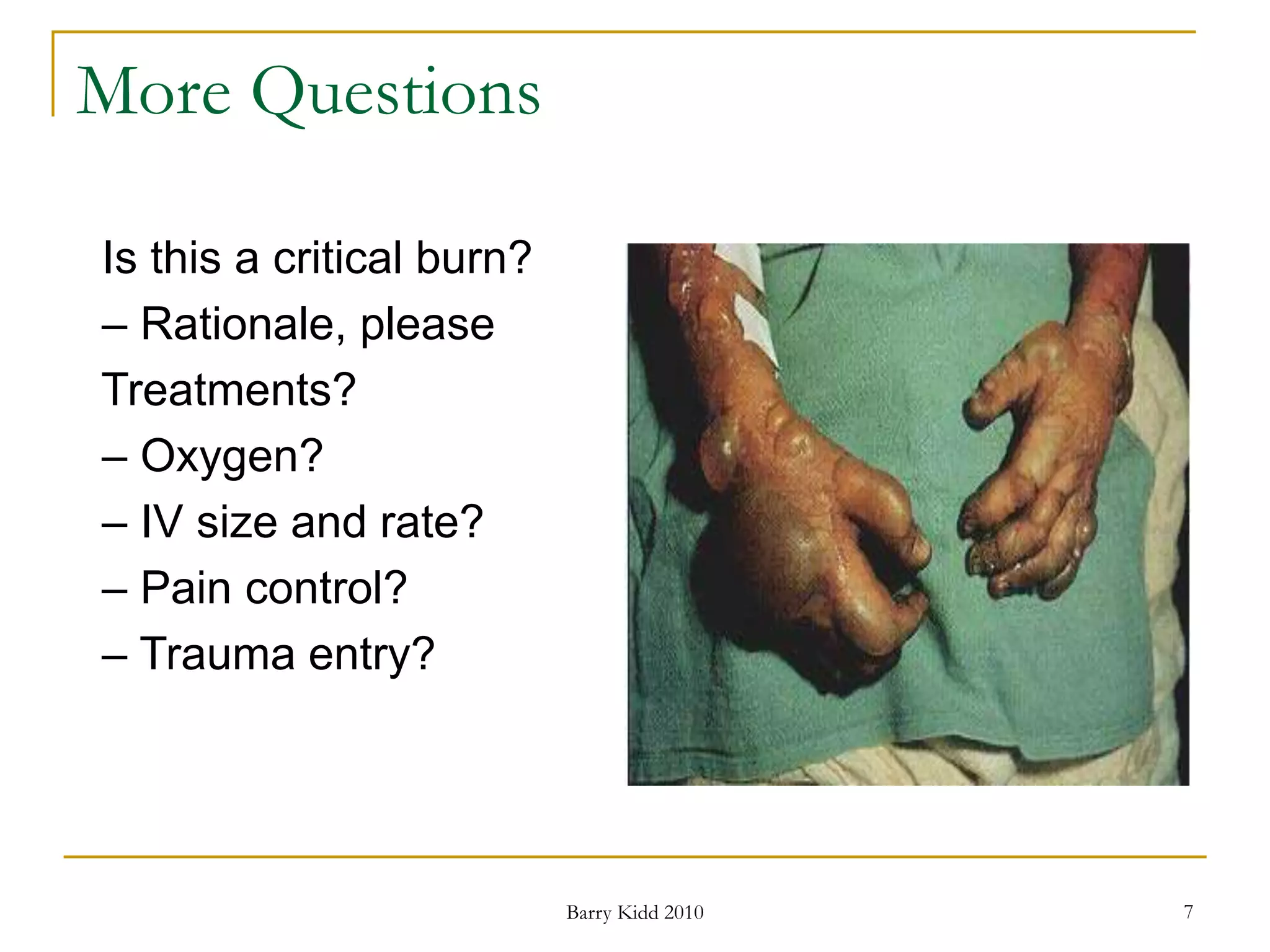 Burn assessment and management | PPT