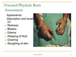 Burn assessment and management | PPT