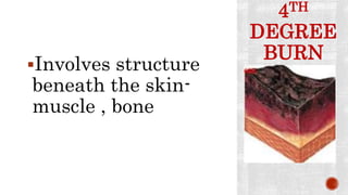 4TH
DEGREE
BURN
Involves structure
beneath the skin-
muscle , bone
 