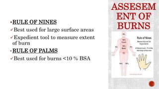 ASSESEM
ENT OF
BURNS
RULE OF NINES
Best used for large surface areas
Expedient tool to measure extent
of burn
• RULE OF PALMS
Best used for burns <10 % BSA
 