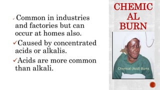 CHEMIC
AL
BURN
 Common in industries
and factories but can
occur at homes also.
Caused by concentrated
acids or alkalis.
Acids are more common
than alkali.
 