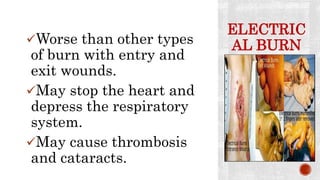 ELECTRIC
AL BURNWorse than other types
of burn with entry and
exit wounds.
May stop the heart and
depress the respiratory
system.
May cause thrombosis
and cataracts.
 