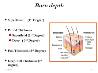 BURN by kng KYR-1.ppt,degrees of burning,classification of burns | PPT