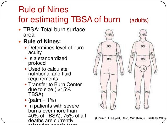 burns embrace discomfort rule of 9 s burn chart child