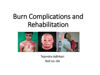Burn Complications and
Rehabilitation
Tejendra Adhikari
Roll no.-04
 