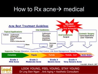 How to Rx acne   medical 