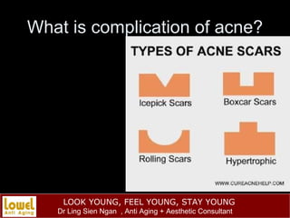 What is complication of acne? 
