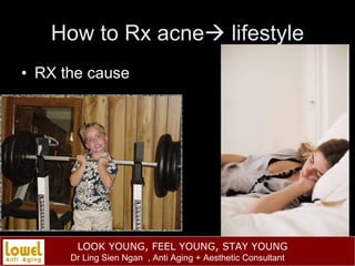 How to Rx acne   lifestyle RX the cause 