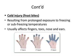 Burn Injury.pptx