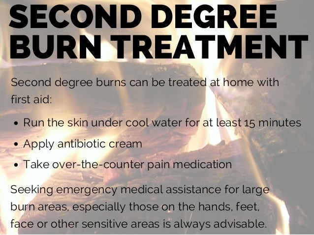 What are some good second-degree burn treatments?