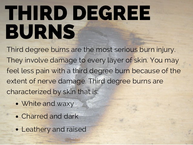 Burn Injury Burn Types, Treatments, and Causes