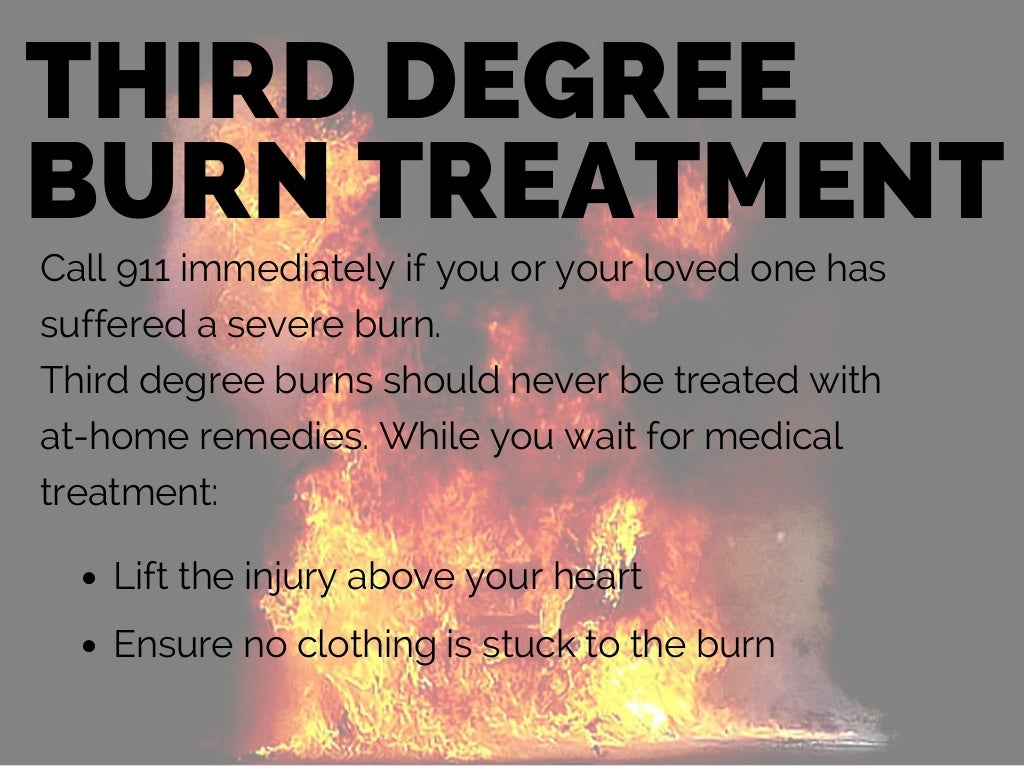 Burn Injury Burn Types, Treatments, and Causes
