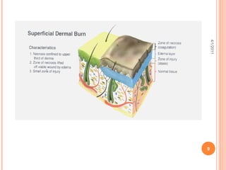 4/1/2011
           9
 