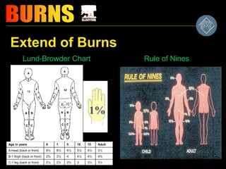 Burn management | PPT