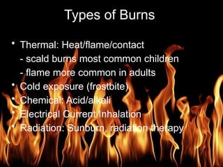 Burn Management is the curing of a burning | PPT