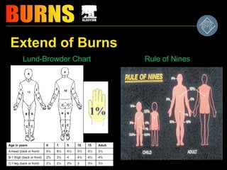 Extend of Burns
Lund-Browder Chart Rule of Nines
Age in years 0 1 5 10 15 Adult
A-head (back or front) 9½ 8½ 6½ 5½ 4½ 3½
B-1 thigh (back or front) 2¾ 3¼ 4 4¼ 4½ 4¾
C-1 leg (back or front) 2½ 2½ 2¾ 3 3¼ 3½
 