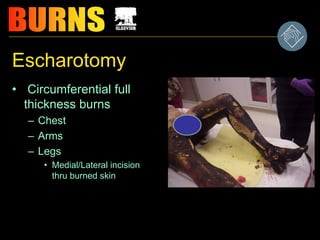 Escharotomy
• Circumferential full
thickness burns
– Chest
– Arms
– Legs
• Medial/Lateral incision
thru burned skin
 