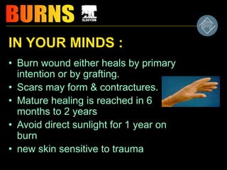 IN YOUR MINDS :
• Burn wound either heals by primary
intention or by grafting.
• Scars may form & contractures.
• Mature healing is reached in 6
months to 2 years
• Avoid direct sunlight for 1 year on
burn
• new skin sensitive to trauma
 