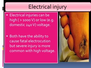 Electrical injury
 Electrical injuries can be
high ( > 1000V) or low (e.g.
domestic 240V) voltage.
 Both have the ability to
cause fatal electrocution
but severe injury is more
common with high voltage.
 