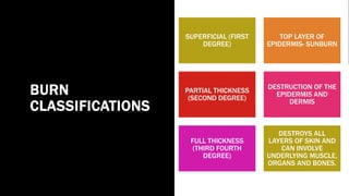 Sun Burn Classification BURN MNT | PPTX