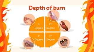 1st
Degree
2nd
Degree
4th
Degree
3rd
Degree
Depth of burn
 