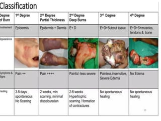 BURN Classification Management and Medico-legal Importance | PPTX