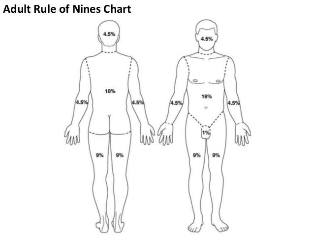 Rule Of Nines Chart Child