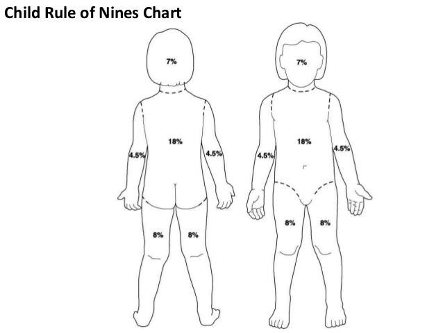 Rule Of Nines Burn Chart