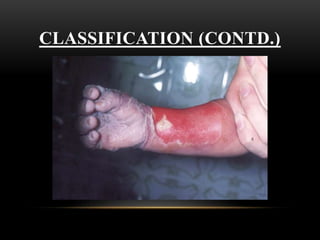 CLASSIFICATION (CONTD.)
 