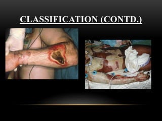 CLASSIFICATION (CONTD.)
 