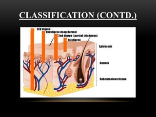 CLASSIFICATION (CONTD.)
 