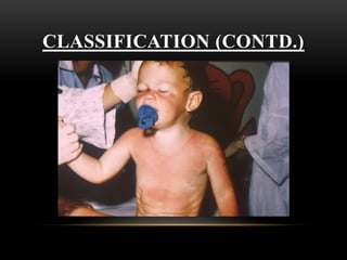 CLASSIFICATION (CONTD.)
 