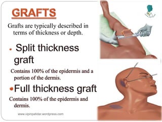 www.vipinpatidar.wordpress.com
Grafts are typically described in
terms of thickness or depth.
 