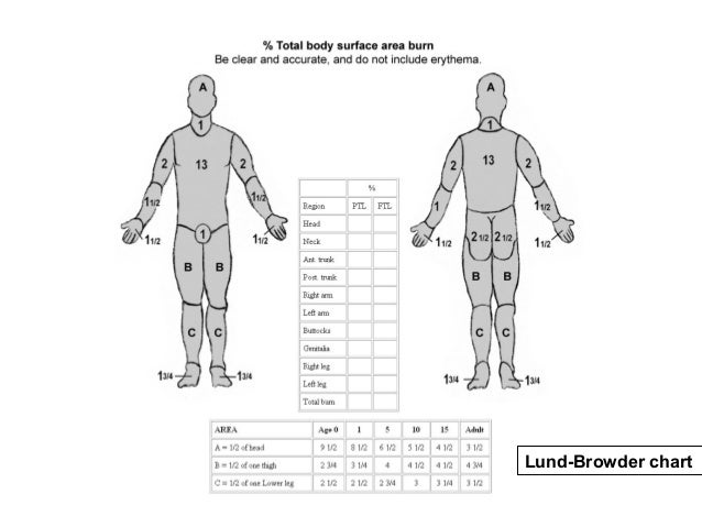 Lund And Browder Chart Explained