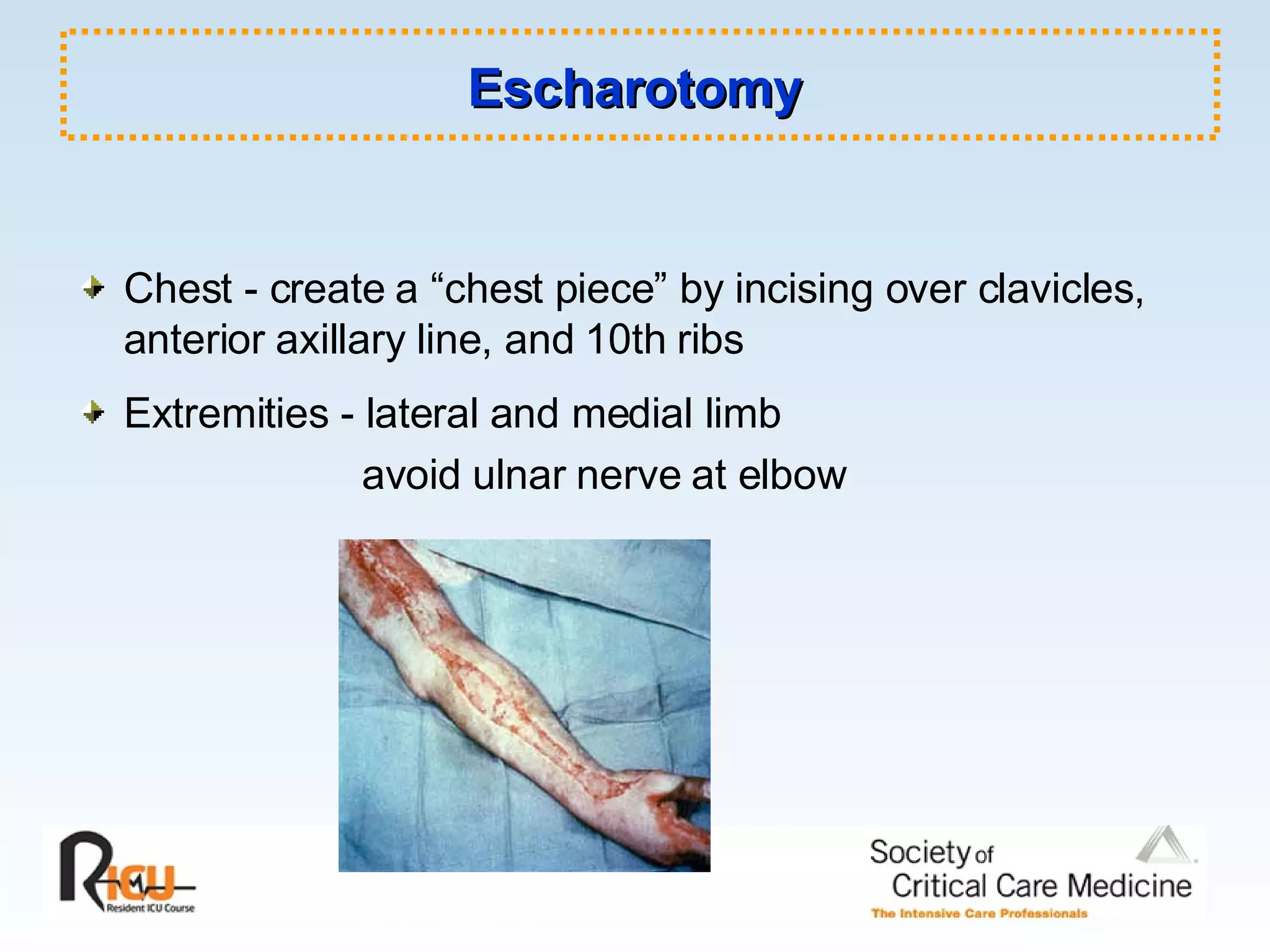 Escharotomy Chest - create a “chest piece” by incising over clavicles, anterior axillary line, and 10th ribs Extremities - lateral and medial limb avoid ulnar nerve at elbow 
