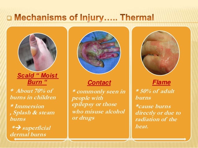 what are the two types of light that can cause burns