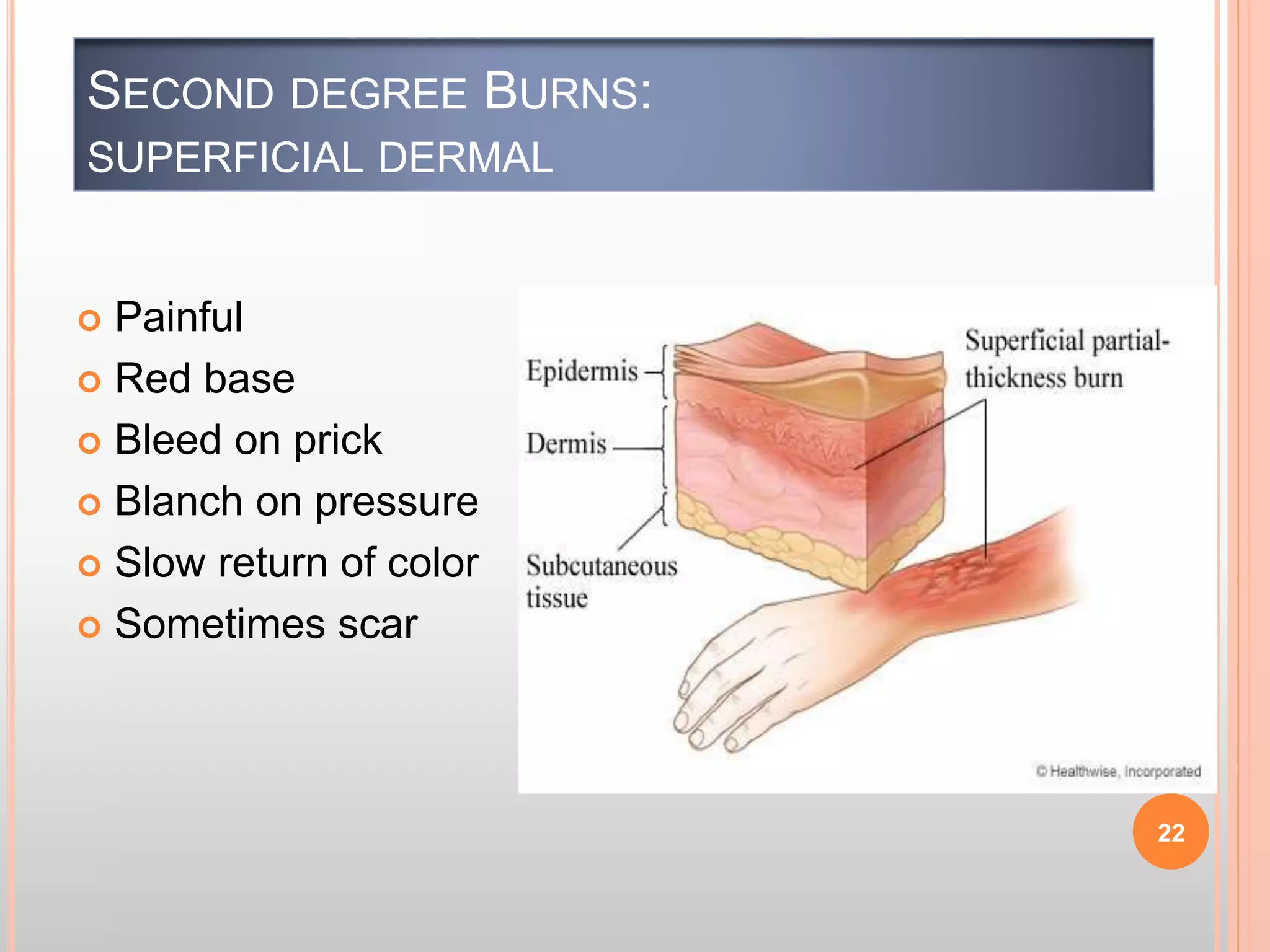 Significant Burn Burn Injury Typess Classification Causes Assesment and Managment | PPTX