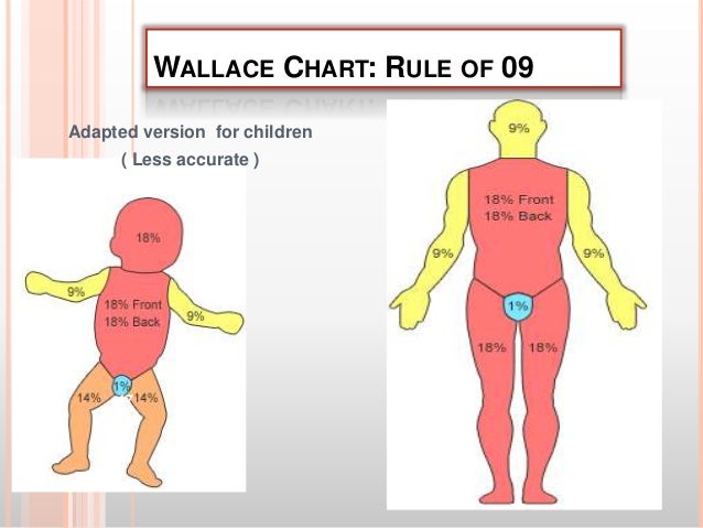 Rule Of 9 S Burn Chart Child