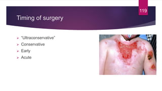 Timing of surgery
 “Ultraconservative”
 Conservative
 Early
 Acute
119
 