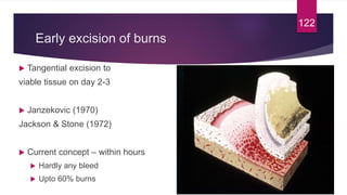 Early excision of burns
 Tangential excision to
viable tissue on day 2-3
 Janzekovic (1970)
Jackson & Stone (1972)
 Current concept – within hours
 Hardly any bleed
 Upto 60% burns
122
 