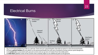 Electrical Burns
23
 