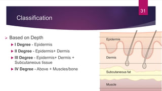 Classification
 Based on Depth
 I Degree - Epidermis
 II Degree - Epidermis+ Dermis
 III Degree - Epidermis+ Dermis +
Subcutaneous tissue
 IV Degree - Above + Muscles/bone
31
 