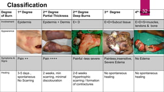 Classification
Degree
of Burn
1st Degree 2nd Degree
Partial Thickness
2nd Degree
Deep Burns
3rd Degree 4th Degree
Involvement Epidermis Epidermis + Dermis E+ D E+D+Subcut tissue E+D+S+muscles,
tendons & bone
Appearance
Symptoms &
Signs
Pain ++ Pain ++++ Painful -less severe Painless,insensitive,
Severe Edema
No Edema
Healing 3-5 days ,
spontaneous
No Scarring
2 weeks, min
scarring, minimal
discolouration
2-6 weeks
Hypertrophic
scarring / formation
of contractures
No spontaneous
healing
No spontaneous
healing
32
 