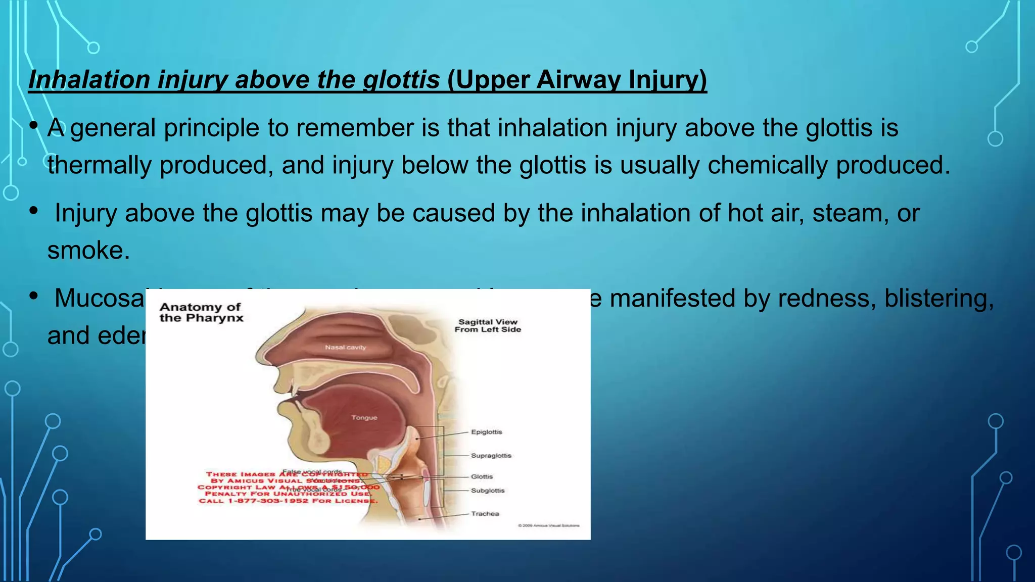 Inhalation injury above the glottis (Upper Airway Injury)
• A general principle to remember is that inhalation injury above the glottis is
thermally produced, and injury below the glottis is usually chemically produced.
• Injury above the glottis may be caused by the inhalation of hot air, steam, or
smoke.
• Mucosal burns of the oropharynx and larynx are manifested by redness, blistering,
and edema.
 
