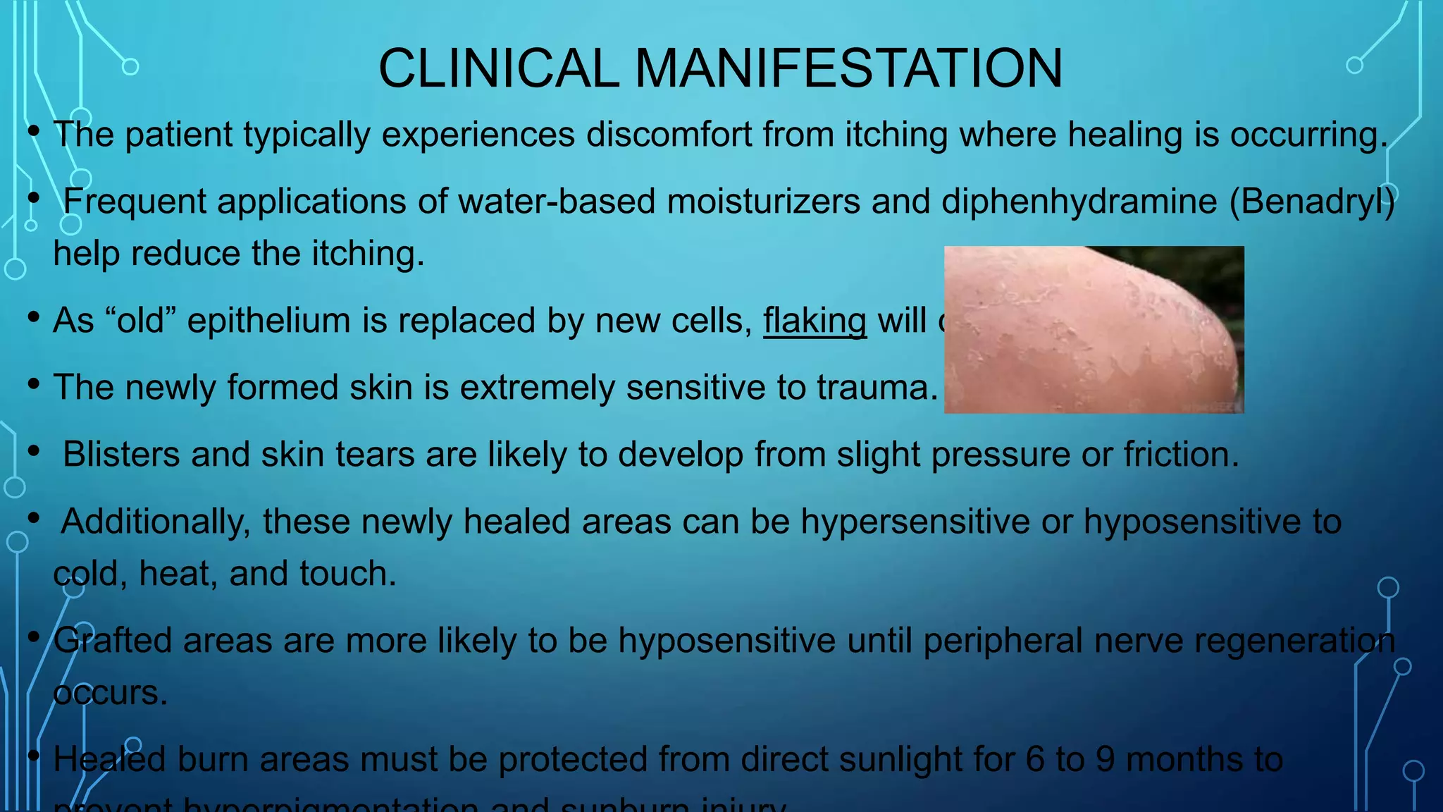 CLINICAL MANIFESTATION
• The patient typically experiences discomfort from itching where healing is occurring.
• Frequent applications of water-based moisturizers and diphenhydramine (Benadryl)
help reduce the itching.
• As “old” epithelium is replaced by new cells, flaking will occur.
• The newly formed skin is extremely sensitive to trauma.
• Blisters and skin tears are likely to develop from slight pressure or friction.
• Additionally, these newly healed areas can be hypersensitive or hyposensitive to
cold, heat, and touch.
• Grafted areas are more likely to be hyposensitive until peripheral nerve regeneration
occurs.
• Healed burn areas must be protected from direct sunlight for 6 to 9 months to
 