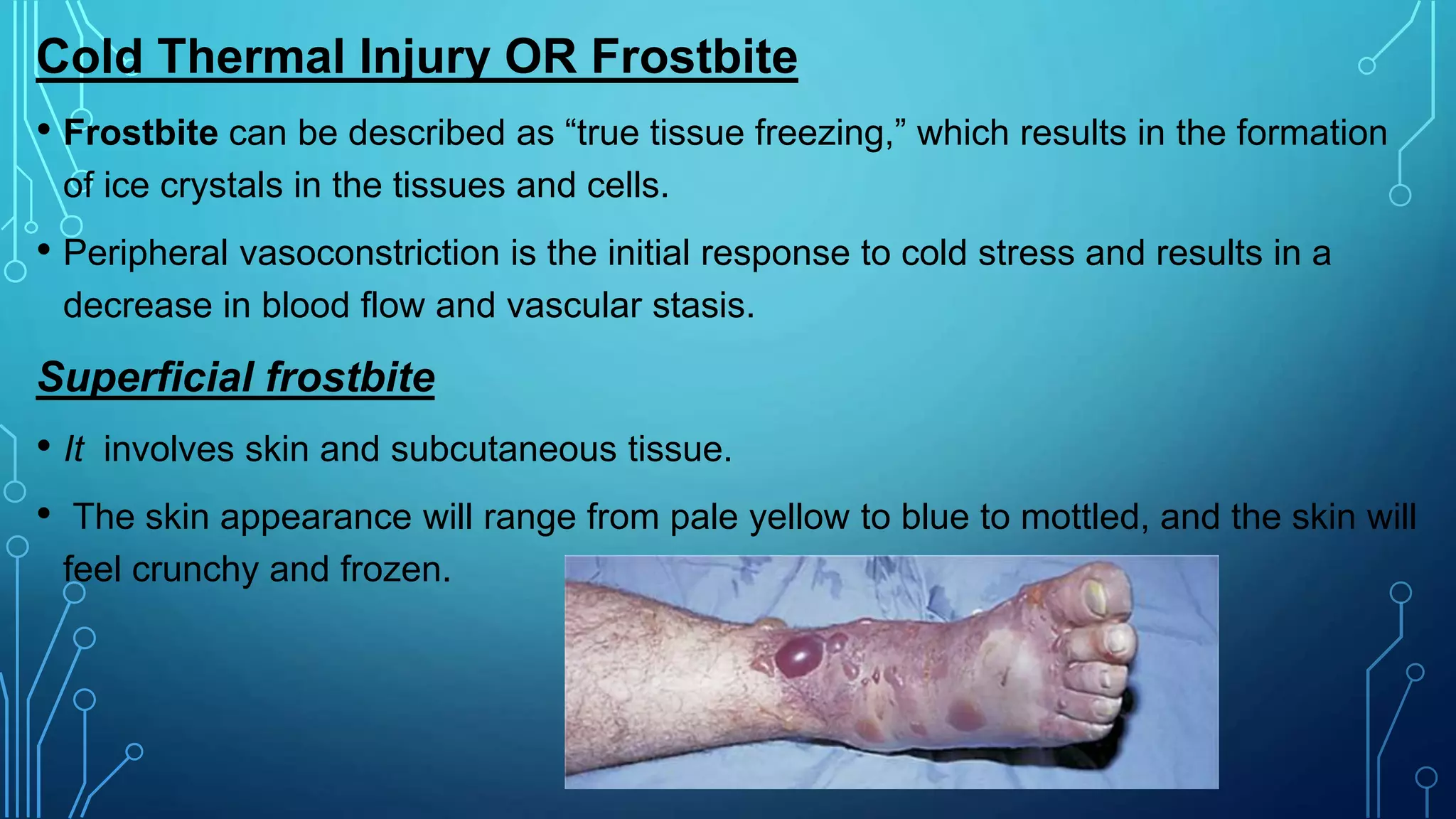 Cold Thermal Injury OR Frostbite
• Frostbite can be described as “true tissue freezing,” which results in the formation
of ice crystals in the tissues and cells.
• Peripheral vasoconstriction is the initial response to cold stress and results in a
decrease in blood flow and vascular stasis.
Superficial frostbite
• It involves skin and subcutaneous tissue.
• The skin appearance will range from pale yellow to blue to mottled, and the skin will
feel crunchy and frozen.
 